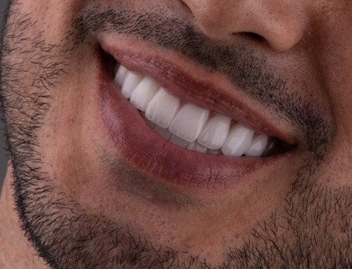 Dentist Marketing Strategies: 25 Proven Ways to Attract More
Patients and Grow Your Practice